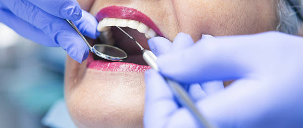 Best Emergency Dental Care for Broken or Chipped Teeth in Brownsville, OR